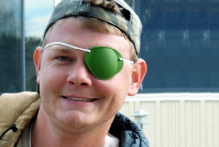 Famous Singer With Eye Patch